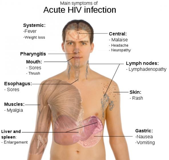 Acure HIV Diagram